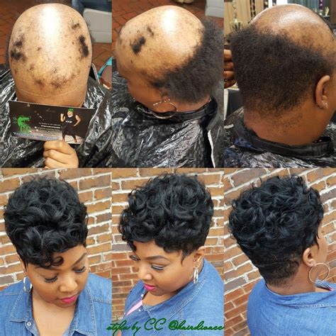best hairstyles for alopecia.